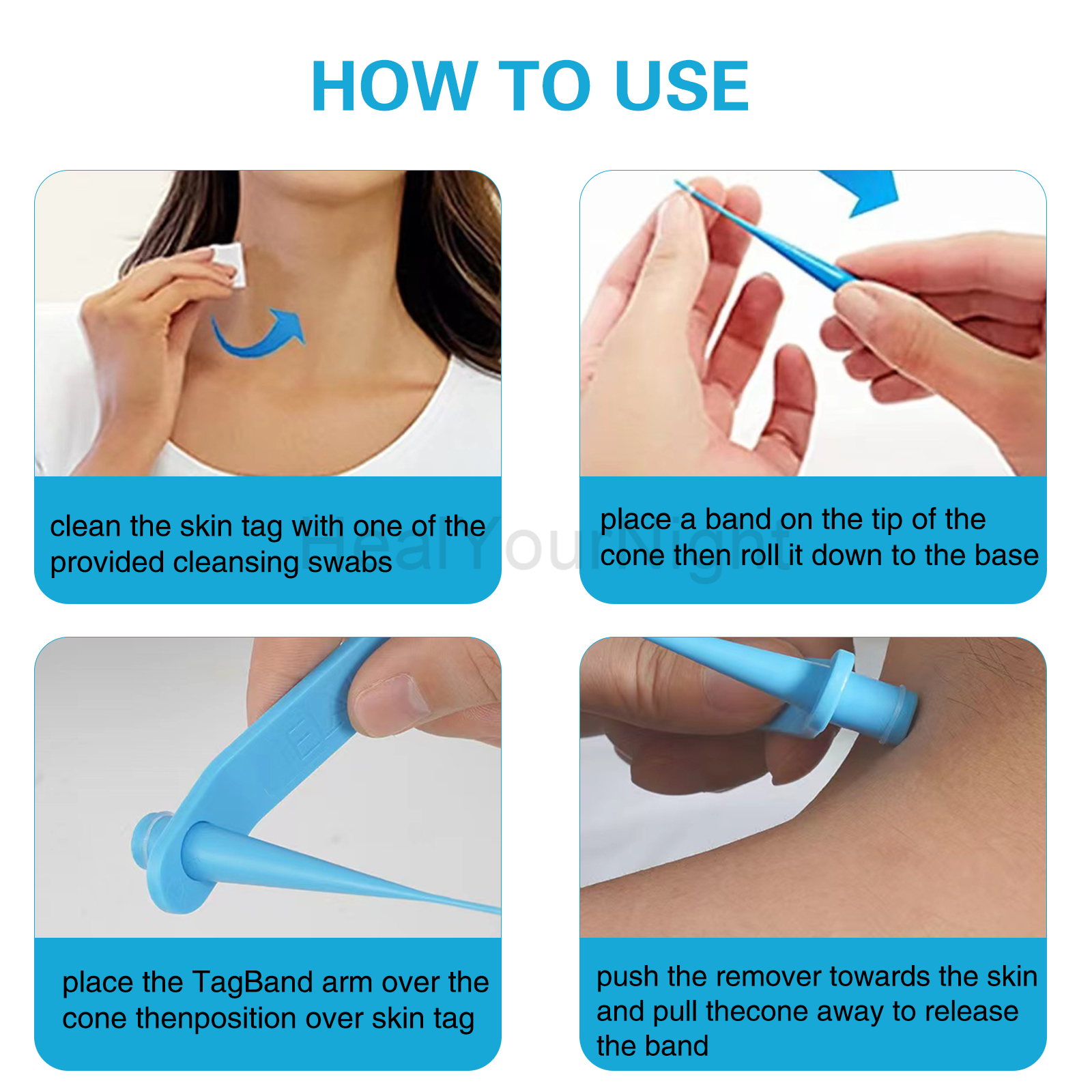 3-IN-1 Auto Skin Tag Removal K – Acne Light Therapy Pen Bewertung und Preis