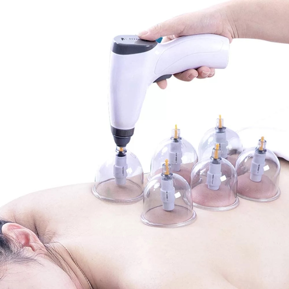 Suction Cup AntiCellulite Elec – Cupping Therapy Set Bewertung und Preis