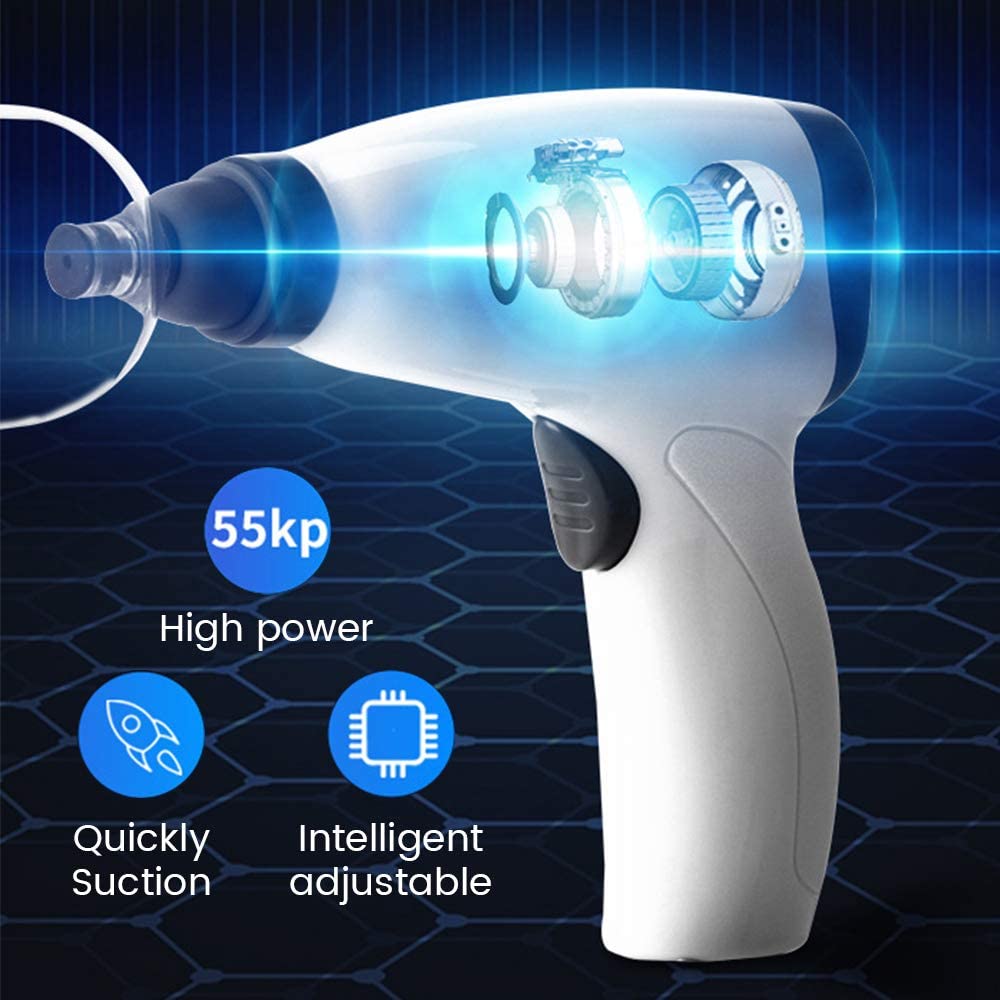 Suction Cup AntiCellulite Elec – Cupping Therapy Set Bewertung und Preis
