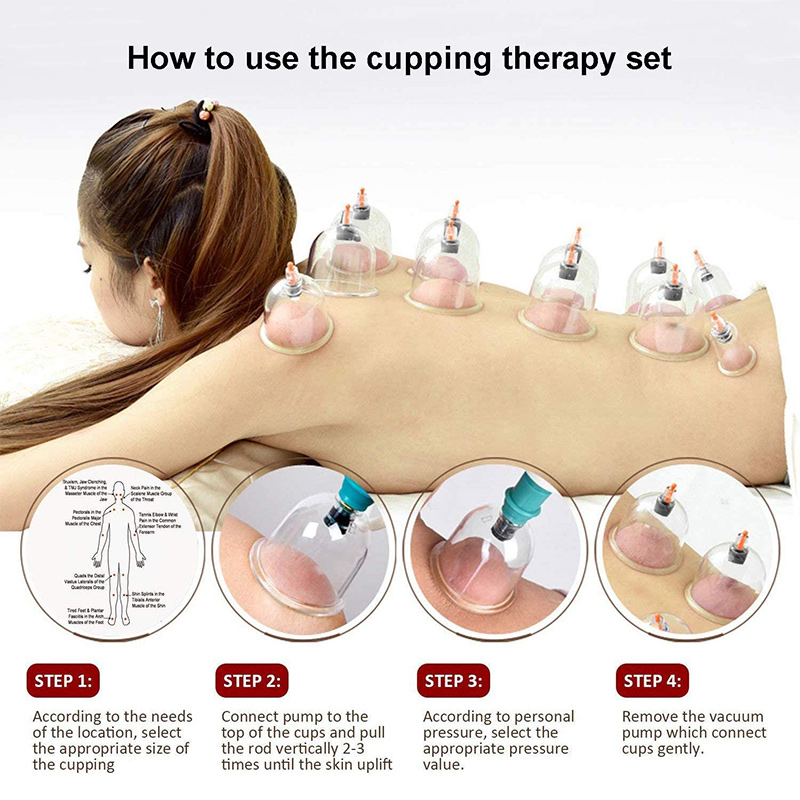 6or24  Pieces Suction Cups Mas – Cupping Therapy Set Bewertung und Preis