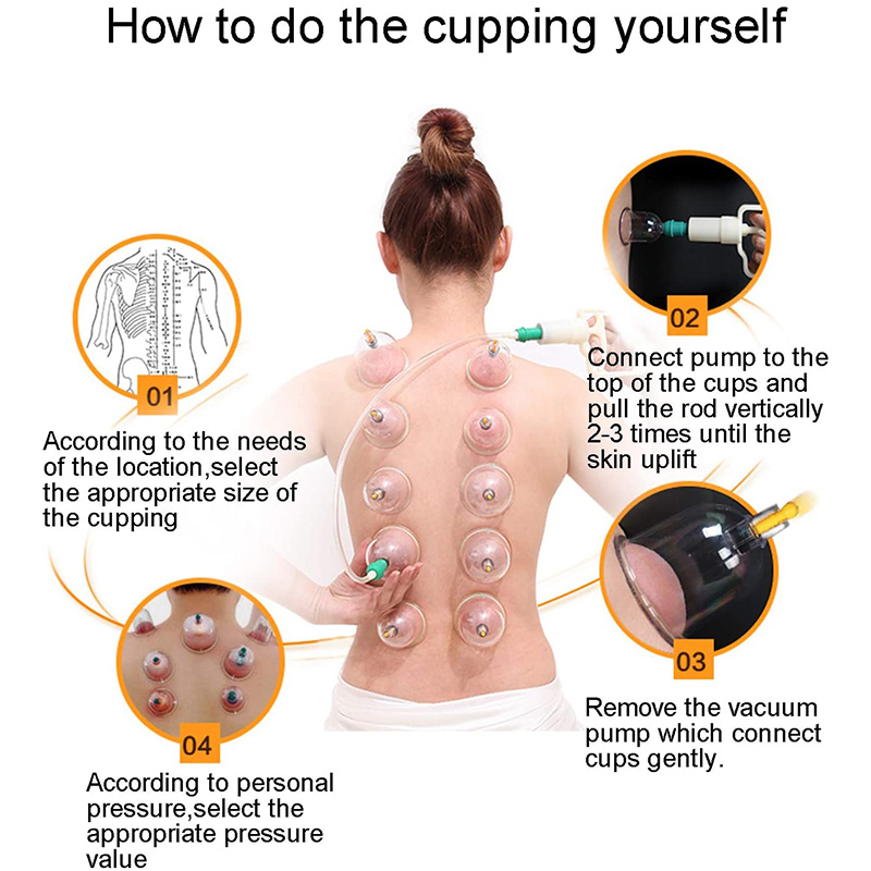 6or24  Pieces Suction Cups Mas – Cupping Therapy Set Bewertung und Preis