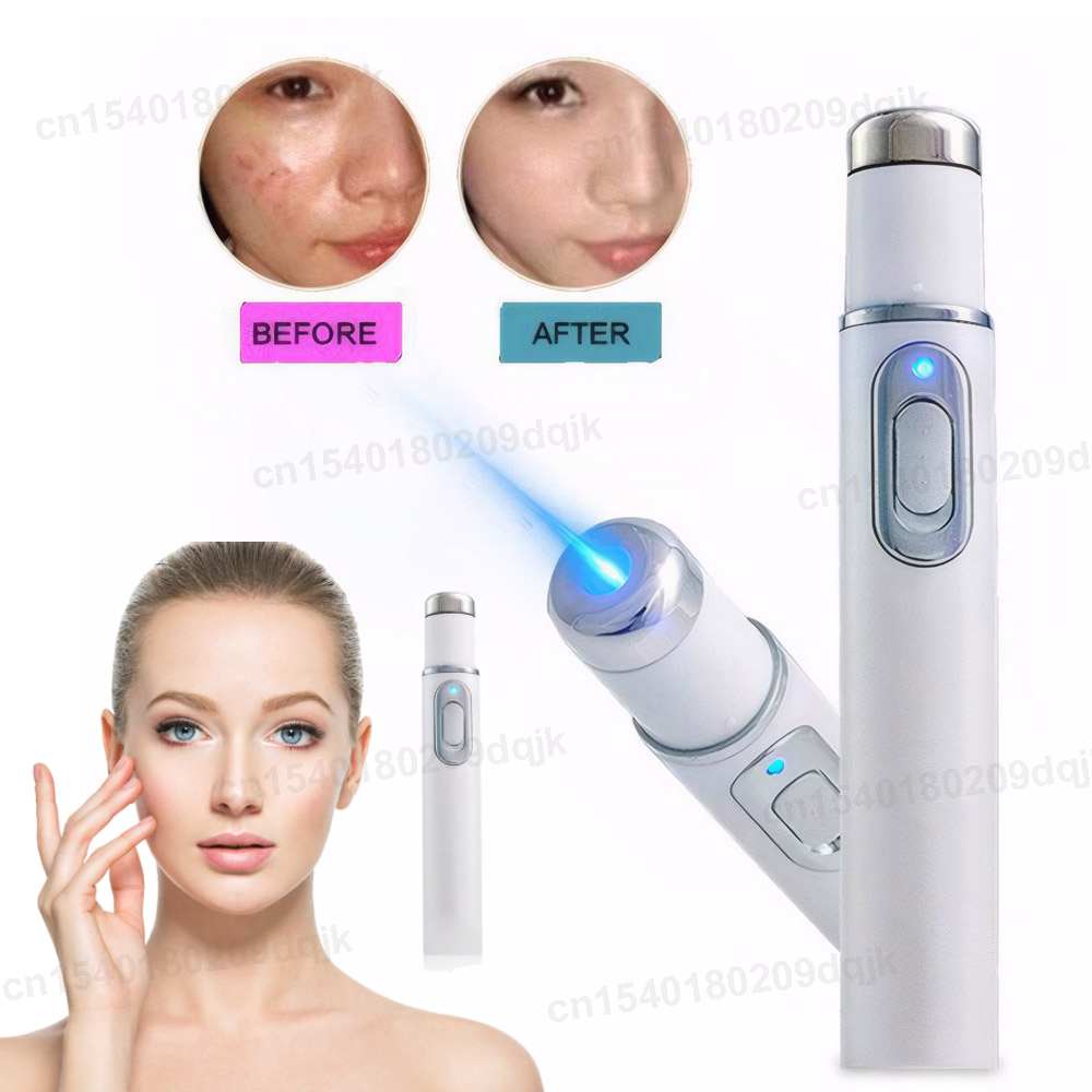 Blue Light Therapy Acne Pen He – Acne Light Therapy Pen Bewertung und Preis