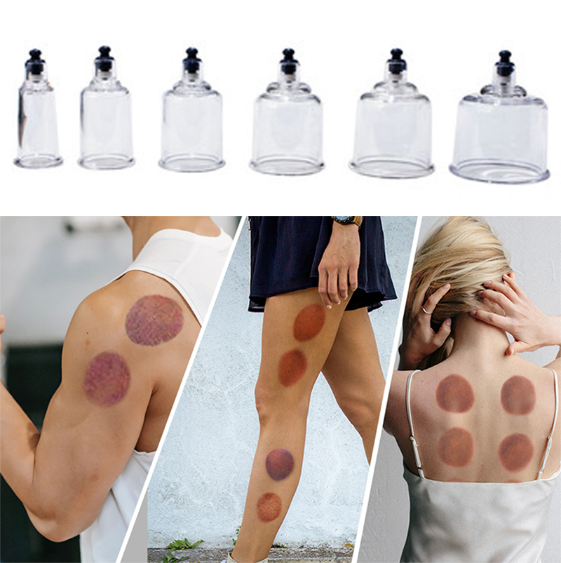 17cans Cupping Therapy Set Ven – Cupping Therapy Set Bewertung und Preis
