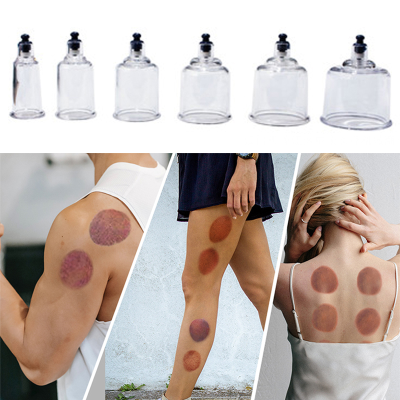 17 Cans Vacuum Cupping Therapy – Cupping Therapy Set Bewertung und Preis