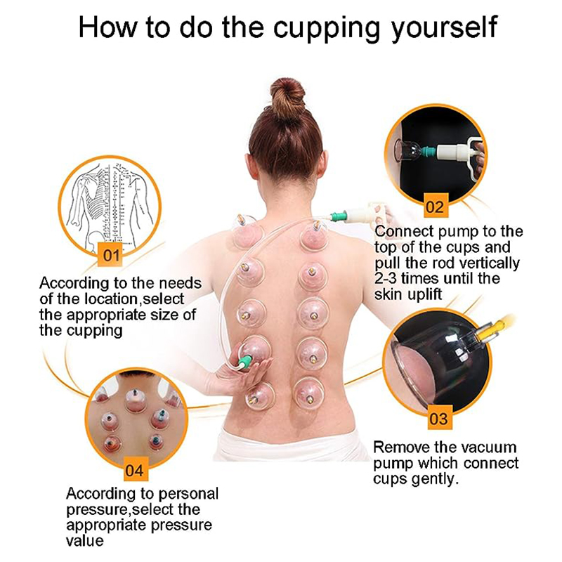 24 Cans JINGKANG Chinese Vacuu – Cupping Therapy Set Bewertung und Preis
