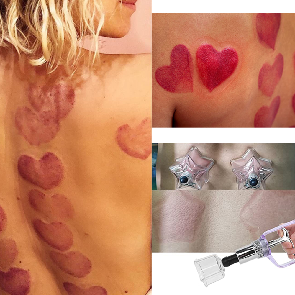 New Style 4 PCS Love-star Shap – Cupping Therapy Set Bewertung und Preis